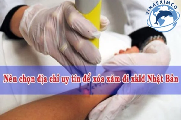 Địa chỉ xóa hình xăm uy tín để đi XKLĐ Nhật Bản
